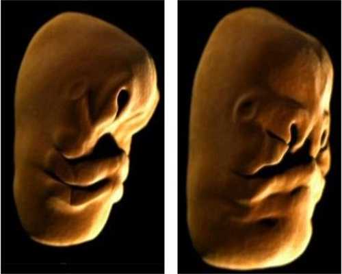 孕妇39周脸上长斑是什么原因_深圳代孕哪里最便