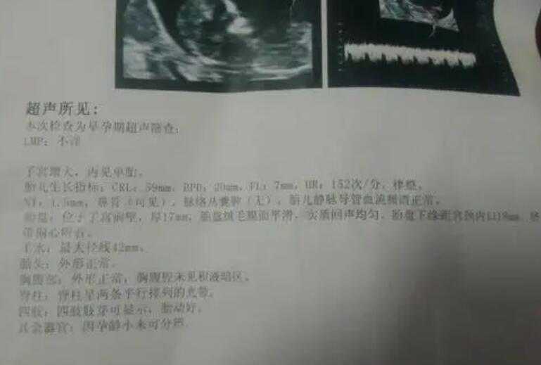 重庆医科大学附属第二医院生殖科哪个医生好？